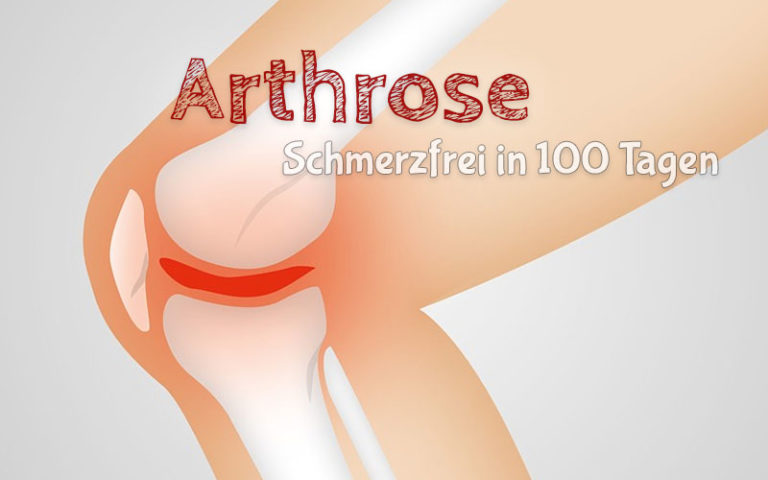 „In 100 Tagen schmerzfrei“ – Neue Wege bei Arthrose