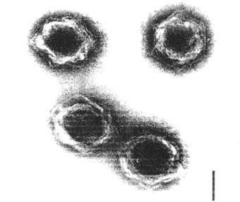 isoliertes virus