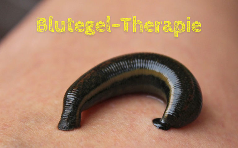 Blutegel-Therapie – eine seit Jahrhunderten bewährte Heilmethode